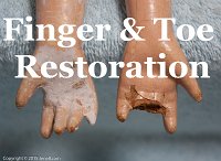 Finger and Toe Restoration